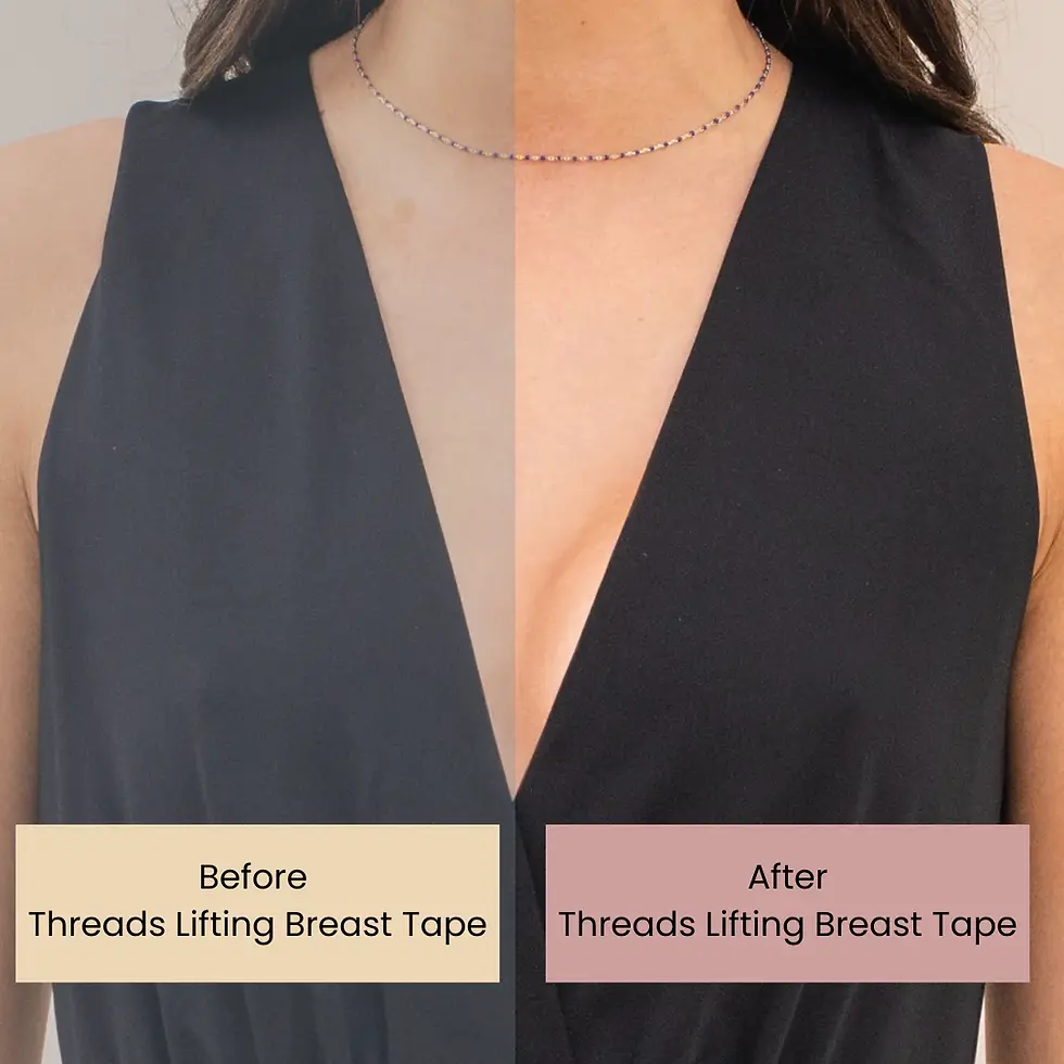 Thumbnail: Threads Lifting Breast Tape, before and after