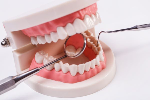 Periodoncia; Maqueta dental