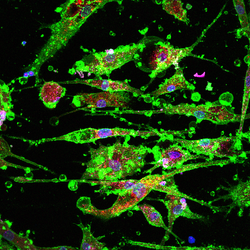 Microglia