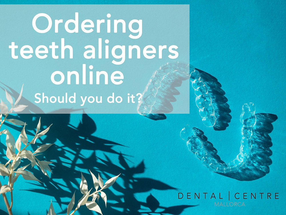 Ordering teeth aligners online 5 reasons why it is not worth your money.