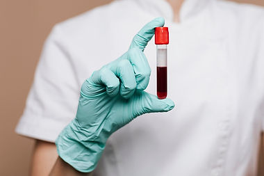 nurse-holding-blood-test-tube_53876-139594.jpg