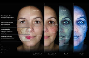 observ-520x-benefits-skin-care-clinic-1.jpg