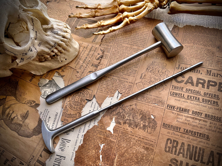 A Procedure Gone Wrong: A Brief History of Lobotomies in the United States