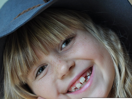 A troca dental