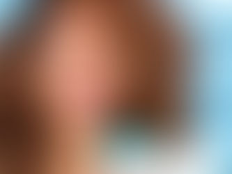 Mitos e verdades sobre clareamento dental que você precisa saber