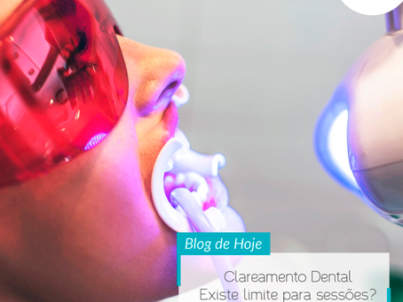 Clareamento Dental – Existe limite para sessões?