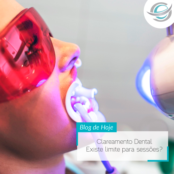 Clareamento Dental – Existe limite para sessões?