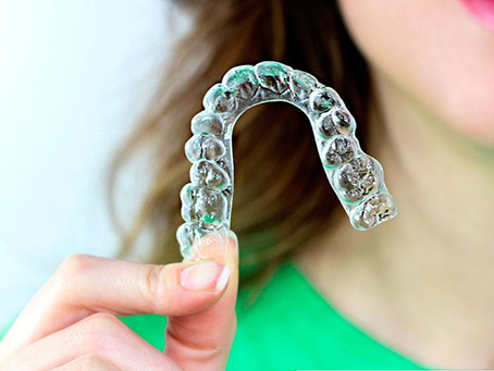 Vantagens do Invisalign
