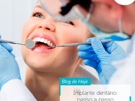 Implante dentário: passo a passo