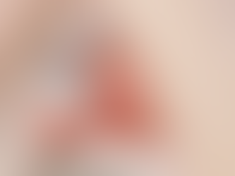 Retinopatia da Prematuridade: um alerta para a principal causa de cegueira em bebês prematuros!