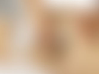 Beneficios de la liposucción sin cirugía