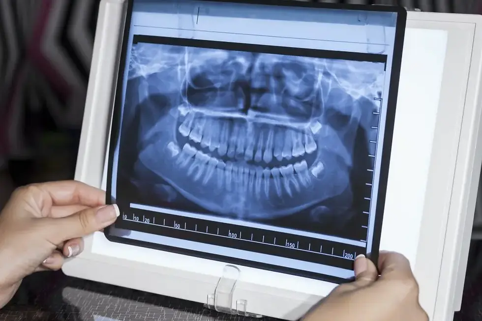 Radiografia Digitale sturla rosalba.webp