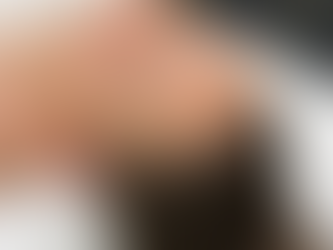 How Soon Can I Wash My Face After Procell Microchanneling?