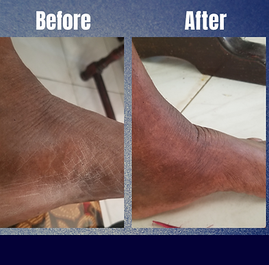 Before and after Templates (2).png