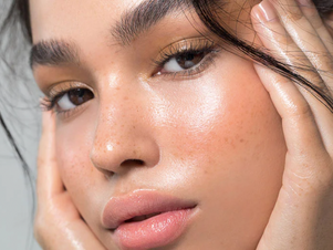 How to Heal and Conceal Rosacea