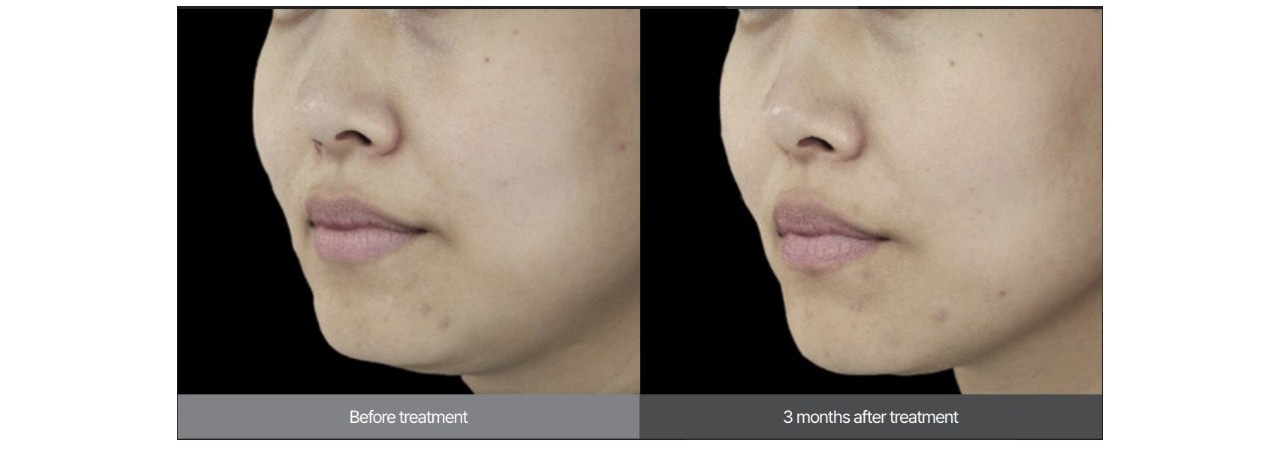 XERF B&A's 2.jpg