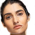 woman with plastic surgery markings on her beautiful face.