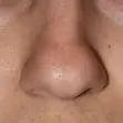 Bulbous boxy tip of nose