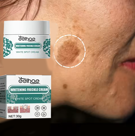 Mild Niacinamide Lightening Melasma Cream Effectively Fade Melanin Bleaching Cre