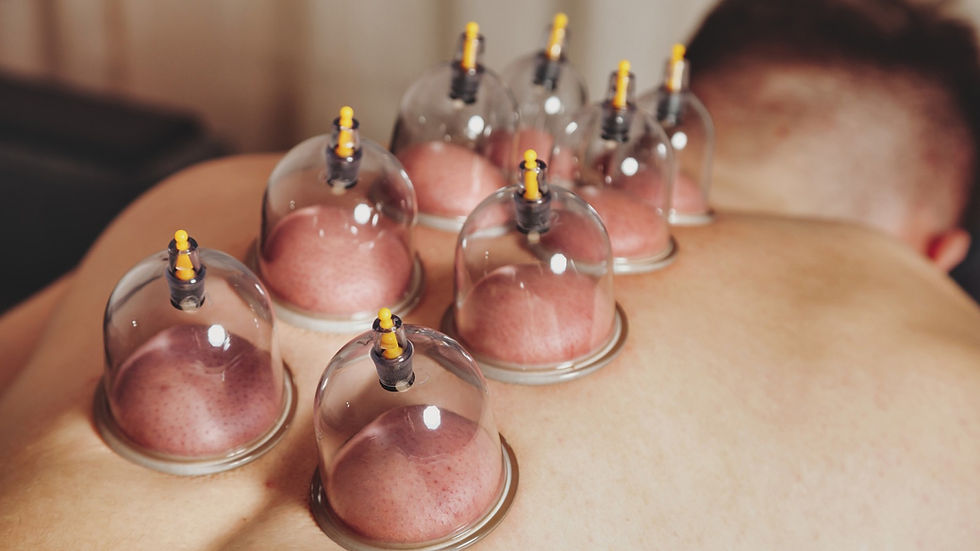 Cupping Therapy Benefits for Athletes and Fitness Enthusiasts