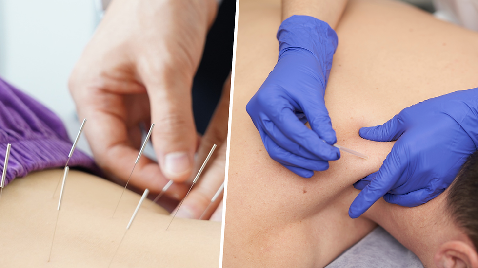 Acupuncture vs Dry Needling: Key Differences and Which One You Need