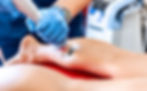 Benefits Patients Often Experience