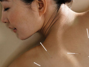 How Acupuncture Helps Reduce Chronic Pain and Improve Sleep