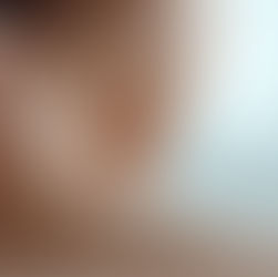 Acupuncture for Migraine Relief: What Science Says