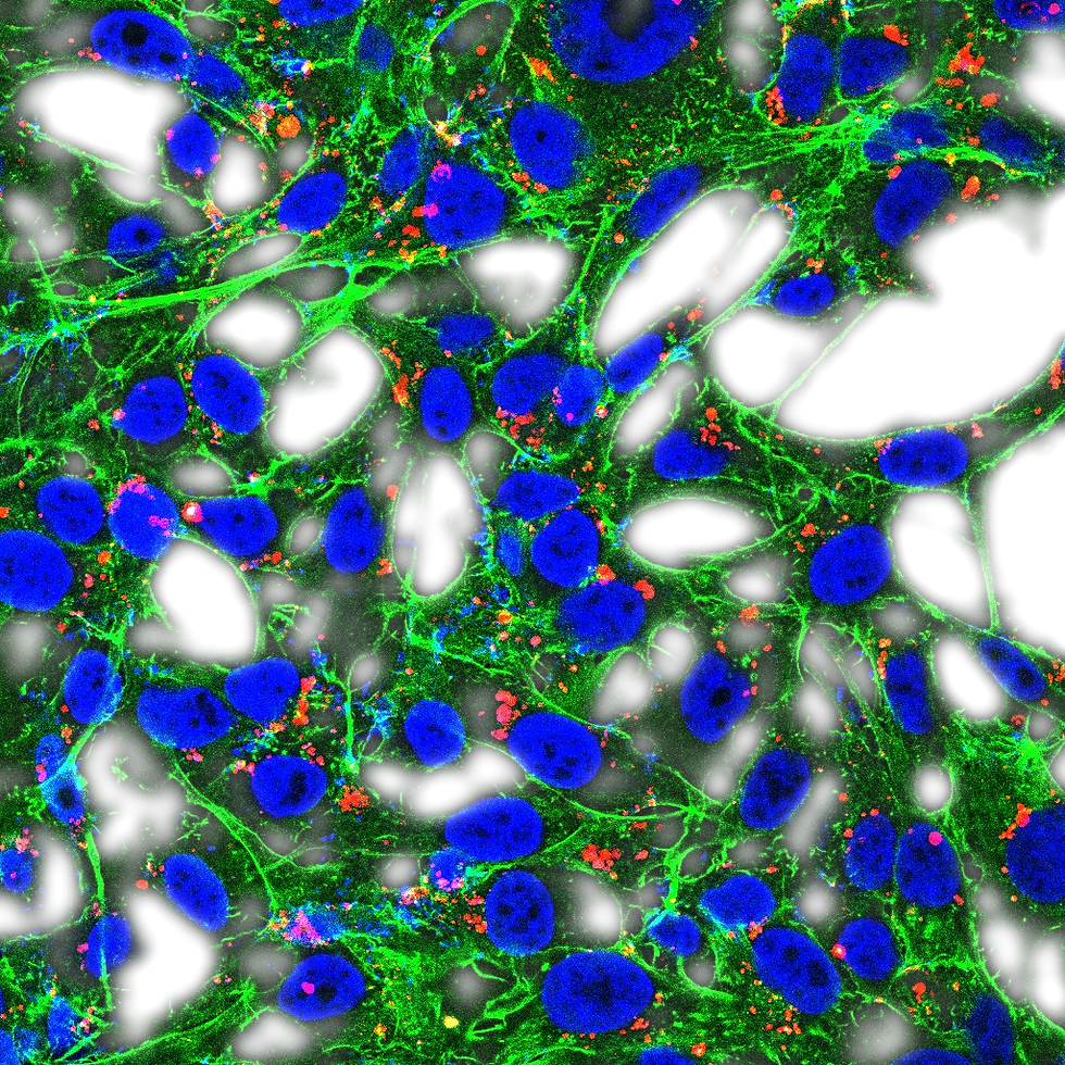 Nano-sized Therapeutic and Diagnostic Tools for Cancer