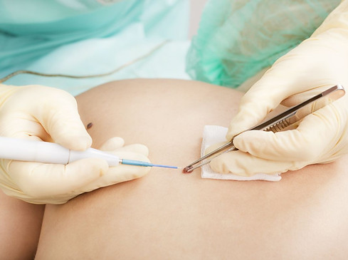 Pequena cirurgia otorosmed.jpg