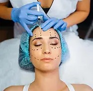 botox.webp
