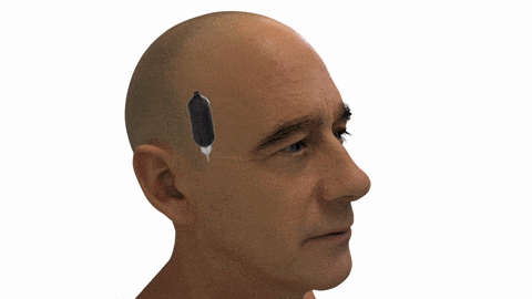 how-it-works-v2-min.gif