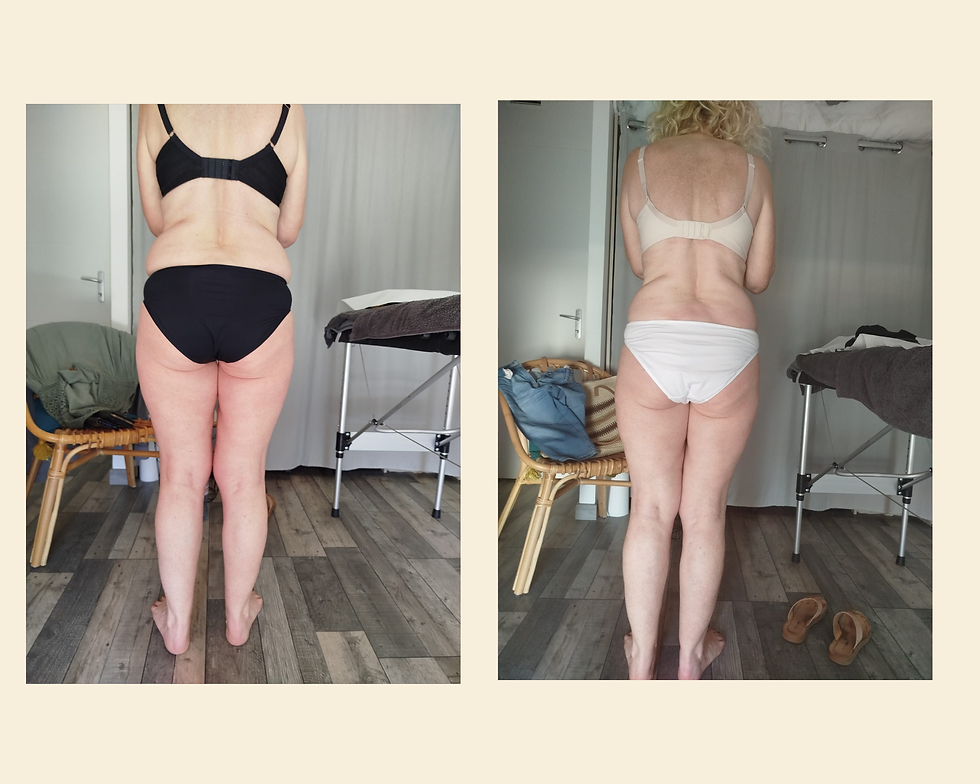 avant/après cure de Drainage Lymphatique méthode Vodder