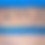 Thumbnail: Deployment Templates