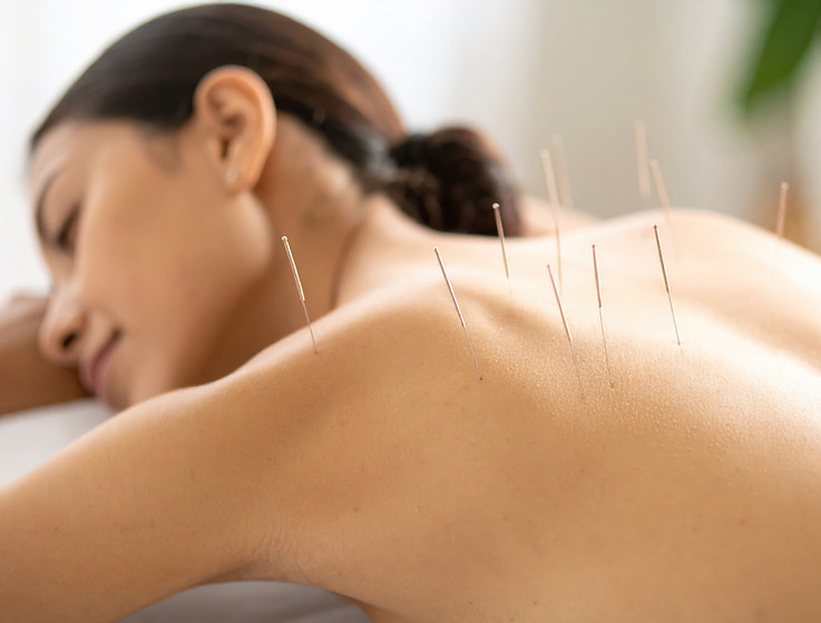 vecteezy_acupuncture-for-back-pain_69690299.jpeg