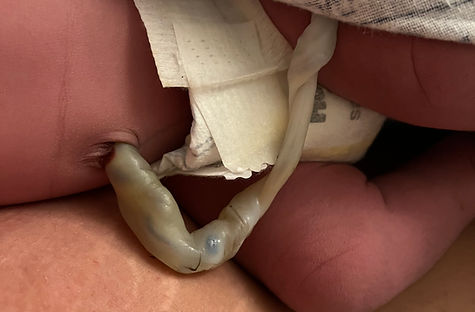 homebirth4.JPEG