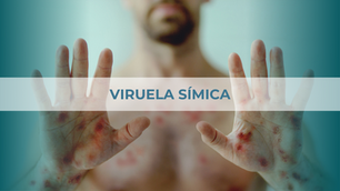 VIRUELA SÍMICA: DIAGNÓSTICO, TRATAMIENTO Y PREVENCIÓN.