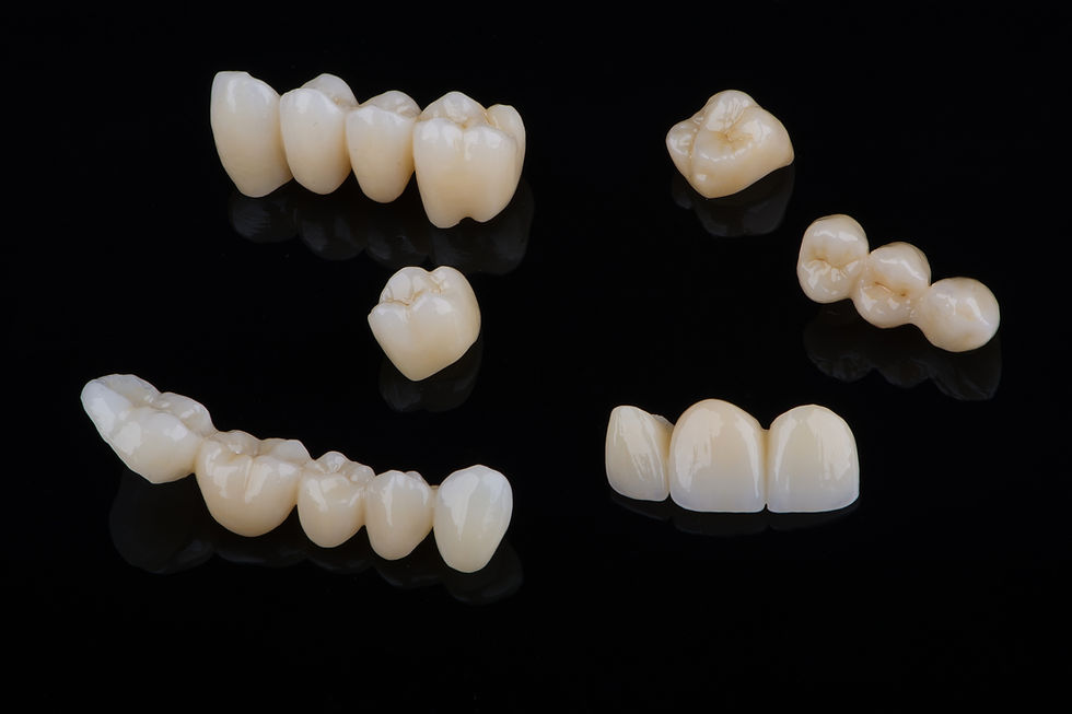 Zirconio monolítico: ofrece alta resistencia mecánica, excelente estabilidad y una estética cada vez más natural. Es ideal para estructuras completas atornilladas.