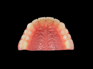 Laboratorio dental de confianza para clínicas nuevas