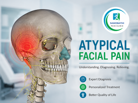 Understanding Atypical Facial Pain Causes