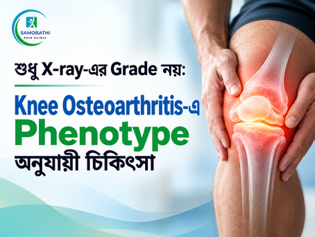 শুধু X-ray-এর Grade নয়: Knee Osteoarthritis-এ Phenotype অনুযায়ী চিকিৎসা