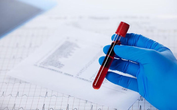 Beijing Gobroad Boren Hospital Director Tong Chunrong: Full Analysis of Six Core Hematological Examinations
