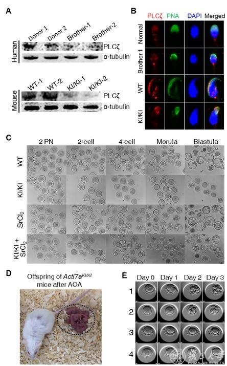 Figure 3: Expression and distribution of PLCζ in sperm and AOA intervention