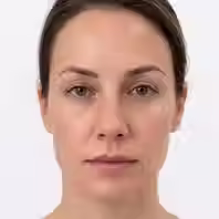 Woman with dull skin tone showing lack of radiance and uneven complexion before skin booster treatment