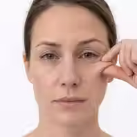 Woman showing early signs of skin laxity and reduced facial elasticity
