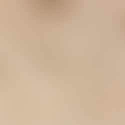 Photo de la pierre naturelle de Bourgogne