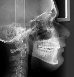 Telerradiografia-Lateral.png