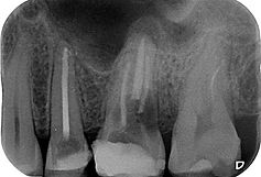 Radiografia-periapical.jpg
