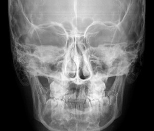 frontal.jpg