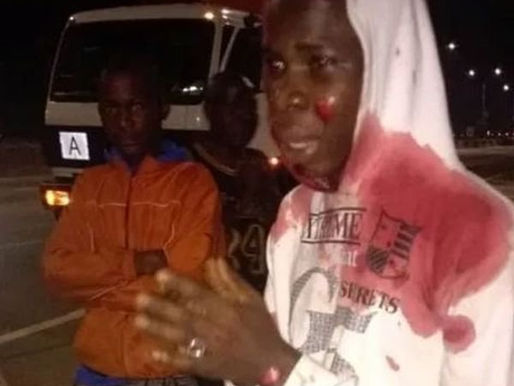 Man Falls Off Speeding Truck On Third Mainland Bridge